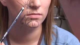 BOTOX PLANO DALLAS TUTORIAL LOWER FACE [upl. by Eiclud]