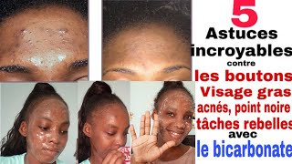 Comment éliminer les boutons tâches points noire visage gras acné avec le bicarbonate 5ASTUCES [upl. by Enillebyam]