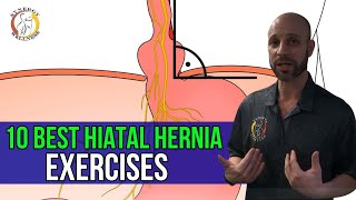 Hiatal Hernia Types Symptoms amp Treatment [upl. by Crispas143]