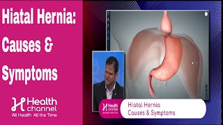 Hiatal Hernia Causes amp Symptoms [upl. by Oeflein]