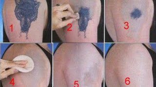 How to Remove a Tattoo without Laser at Home [upl. by Akimas]