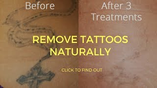 How To Remove Tattoos Naturally [upl. by Seeto]