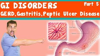 GI Disorders GERD Gastritis peptic ulcer Disease Part 5 [upl. by Bergen823]