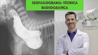 Esofagograma  Técnica radiográfica [upl. by Sandeep926]