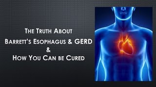 How To Cure Barretts Esophagus  The Truth About Barretts Esophagus [upl. by Araec306]