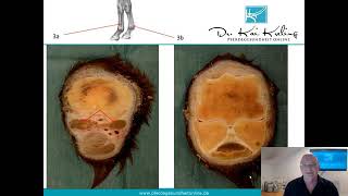 Fesselträger des Pferdes Diagnose  Therapie  Prognose [upl. by Arleen69]