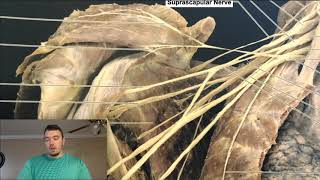 Brachial Plexus EXPLAINED Using a Cadaver [upl. by Vida708]