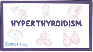 Hyperthyroidism  an Osmosis Preview [upl. by Sande671]