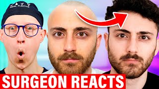 Nathaniel Drew Going Bald Surgeon Reacts [upl. by Yanad]