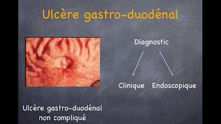 Ulcère gastrique et duodénal Gastrite [upl. by Suertemed]