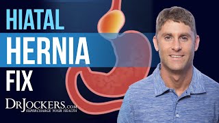 Fix Hernia Naturally [upl. by Leckie75]