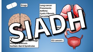 SIADH EXPLAINED Hyponatraemia [upl. by Atinram]