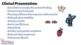 Ankylosing Spondylitis Summarized in 3 Minutes for HCPs Presentation  Diagnosis  Treatment [upl. by Airakaz]