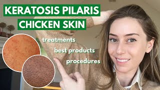 Keratosis Pilaris How to treat dry bumpy skin aka chicken skin  Dr Shereene Idriss [upl. by Trainor]