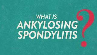 What Is Ankylosing Spondylitis Know the Symptoms  Backsplaining [upl. by Lusar]